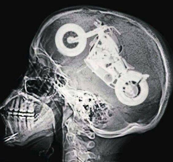 Inside a bikers brain | LBT Motorcycle Recovery | London 020 7228 0800