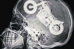 Inside a bikers brain | LBT Motorcycle Recovery | London 020 7228 0800